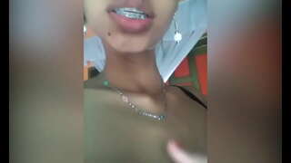 ���ີ່ຫໍ້ໃຫມ່ກັນການໃຄ່ບວມ